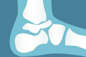 Calcium Intake in Asias Populous Countries Barely Hitting Half The Recommended Daily Intake